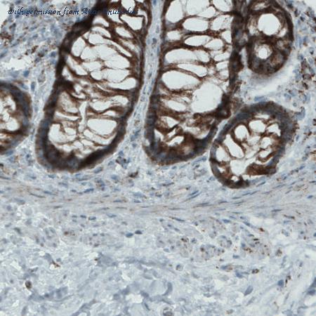 Atlas Antibodies AMAb90832 image 3