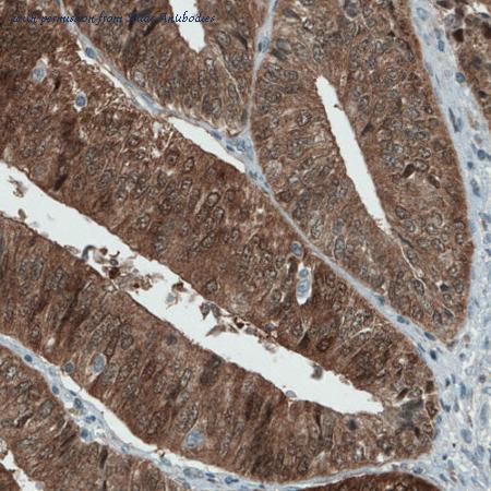 Atlas Antibodies AMAb90907 image 1