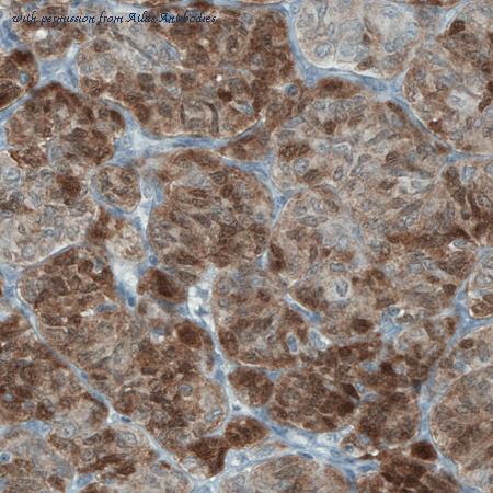 Atlas Antibodies AMAb90907 image 2