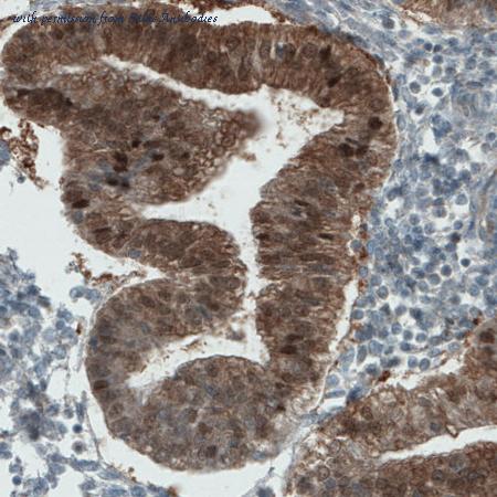 Atlas Antibodies AMAb90907 image 3