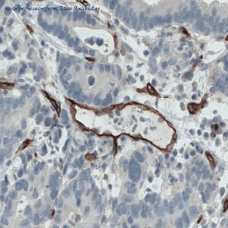 Atlas Antibodies AMAb90925 image 3