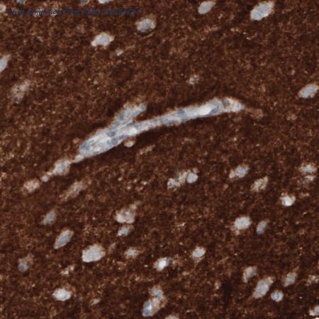 Atlas Antibodies AMAb91041 image 3