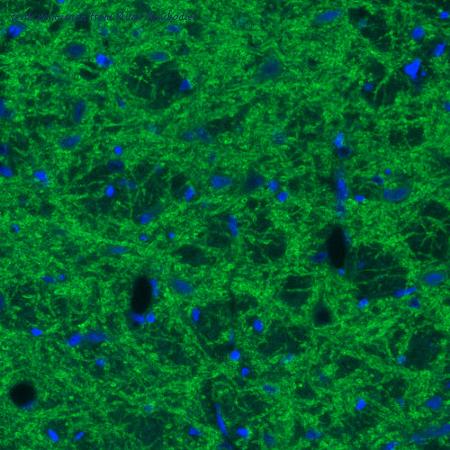 Atlas Antibodies AMAb91043 image 1