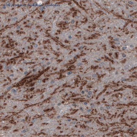 Atlas Antibodies AMAb91043 image 3