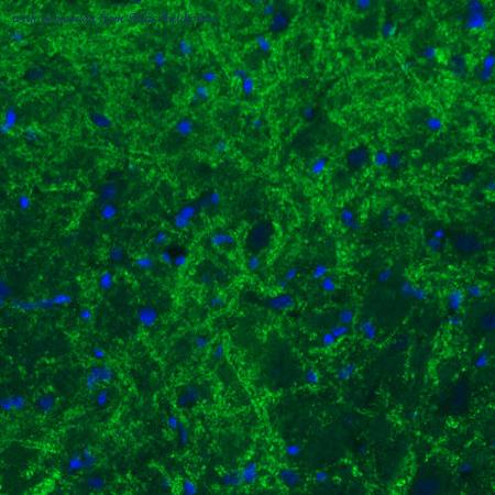 Atlas Antibodies AMAb91048 image 1