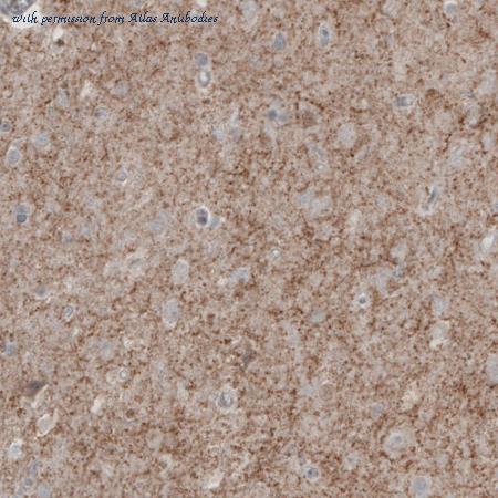 Atlas Antibodies AMAb91048 image 3