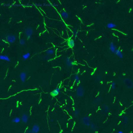 Atlas Antibodies AMAb91072 image 1