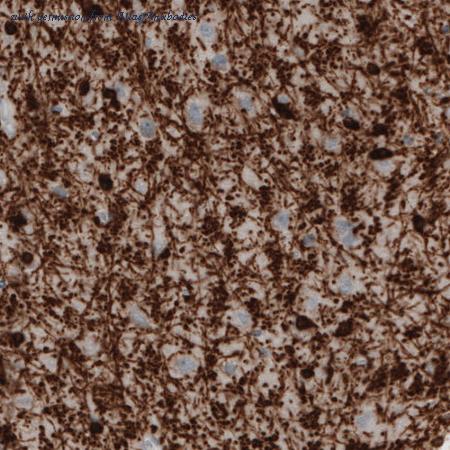 Atlas Antibodies AMAb91072 image 3