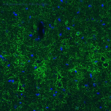 Atlas Antibodies AMAb91079 image 2