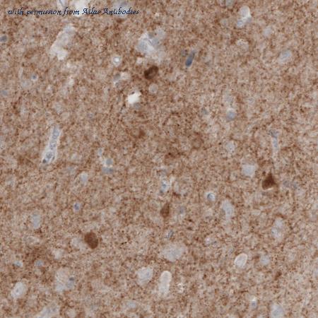 Atlas Antibodies AMAb91079 image 3