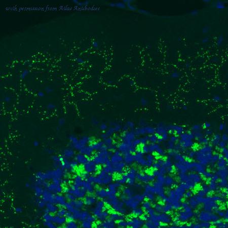 Atlas Antibodies AMAb91081 image 1