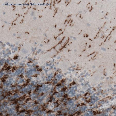 Atlas Antibodies AMAb91081 image 3