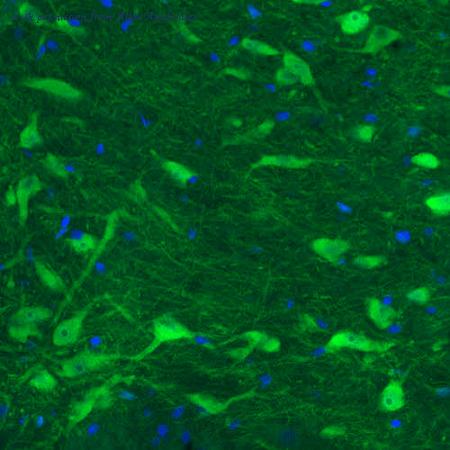Atlas Antibodies AMAb91089 image 1