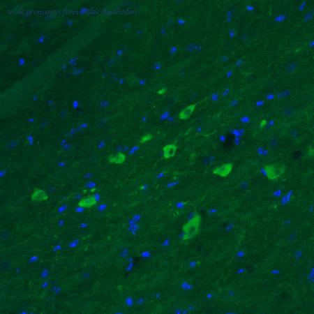 Atlas Antibodies AMAb91089 image 2