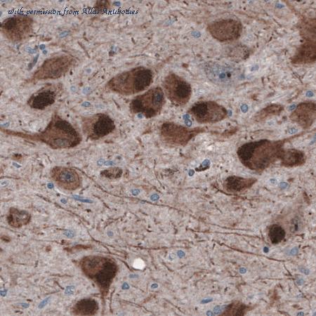 Atlas Antibodies AMAb91089 image 3