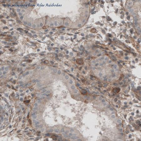 Atlas Antibodies AMAb91092 image 3