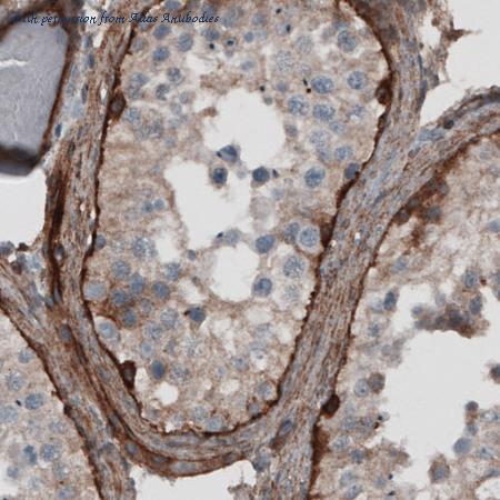 Atlas Antibodies AMAb91097 image 2