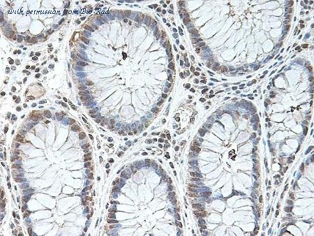 Bio-Rad AHP960 image 1