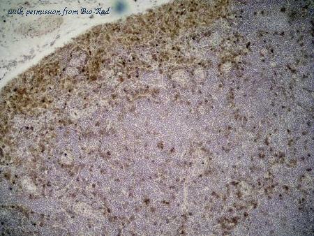 Bio-Rad MCA618R image 1