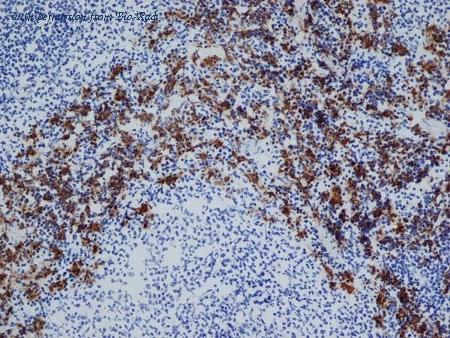 Bio-Rad MCA342PE image 1