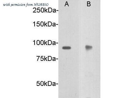 HUABIO 0911-5 image 1