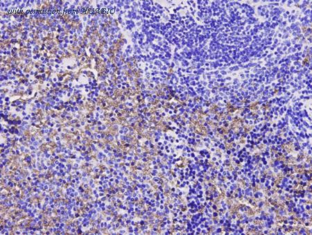 HUABIO EM0704 image 2