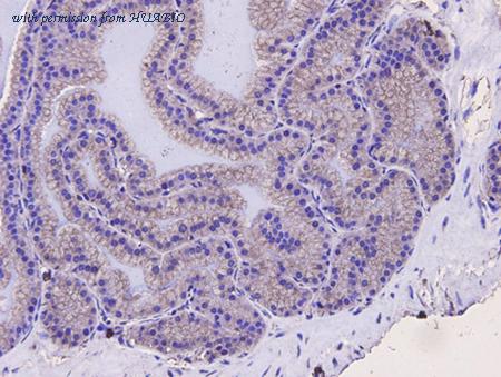 HUABIO EM0704 image 3