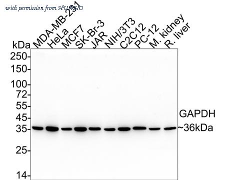 HUABIO EM1101 image 1