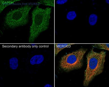 HUABIO EM1101 image 2