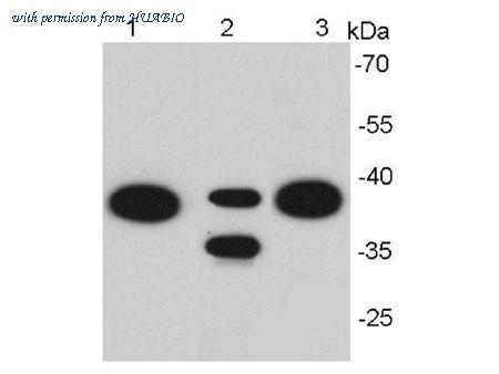 HUABIO EM1111 image 1