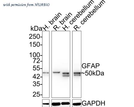 HUABIO EM140707 image 1