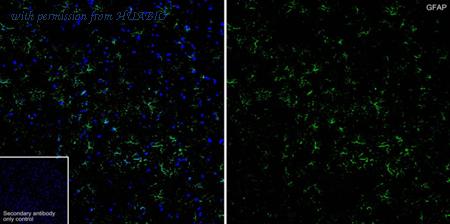 HUABIO EM140707 image 2