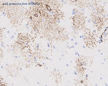 HUABIO EM140707 image 3