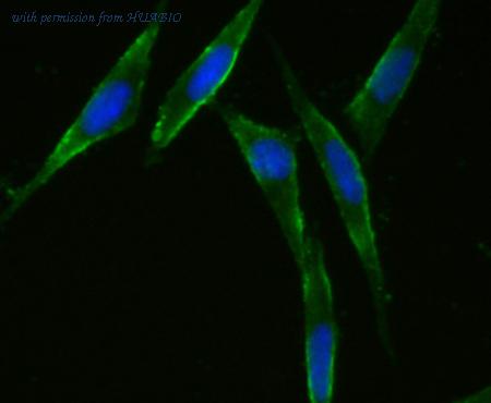 HUABIO EM1701-38 image 1