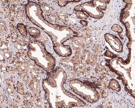 HUABIO EM1701-38 image 3