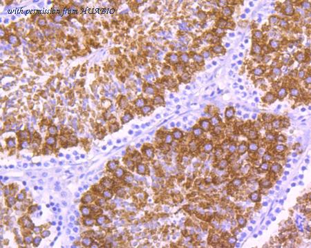 HUABIO EM1701-40 image 2