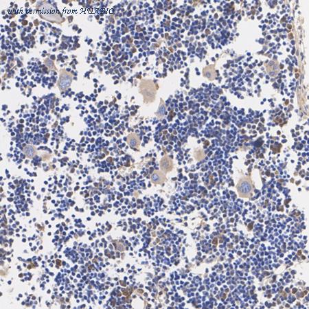 HUABIO EM1701-52 image 2