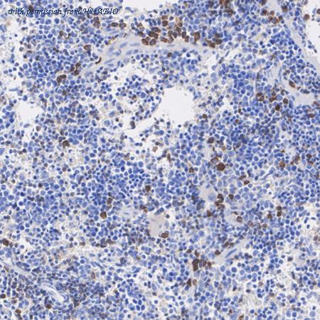 HUABIO EM1701-52 image 3