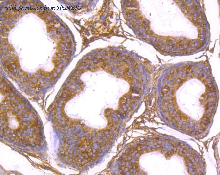 HUABIO EM1701-53 image 3