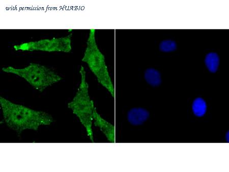 HUABIO EM1701-55 image 2