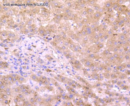 HUABIO EM1701-56 image 1