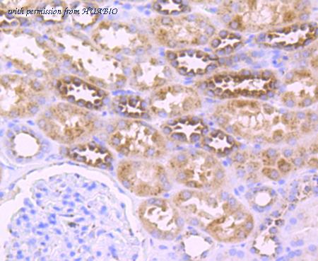 HUABIO EM1701-56 image 2