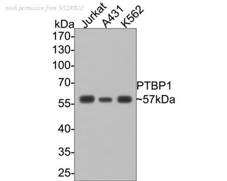 HUABIO EM1701-63 image 1