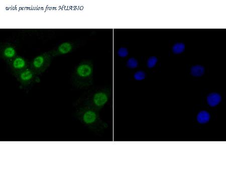 HUABIO EM1701-63 image 2