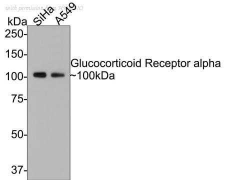 HUABIO EM1701-65 image 1