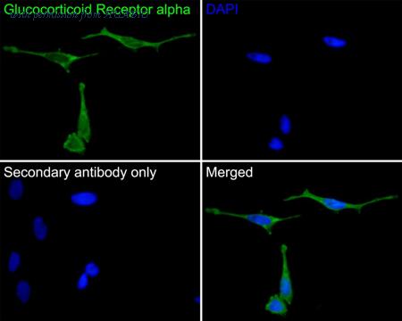 HUABIO EM1701-65 image 2