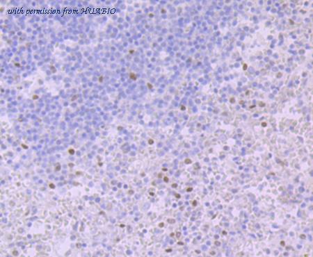 HUABIO EM1701-65 image 3