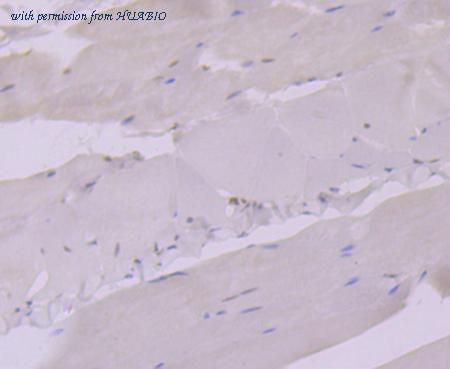 HUABIO EM1701-66 image 3