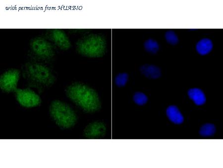 HUABIO EM1701-67 image 2