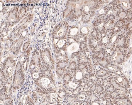 HUABIO EM1701-67 image 3